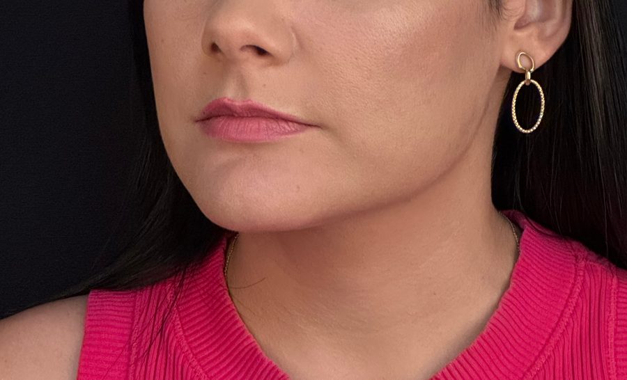 Resultado — Implantes Faciais